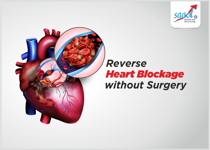 Reverse Heart Blockage without Surgery