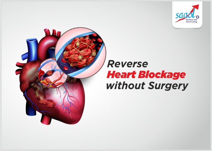 Reverse Heart Blockage Without Surgery