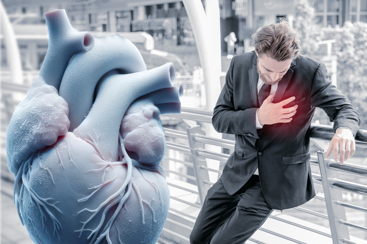 Chest Pain in Cold Weather vs. Winter Heart Attack