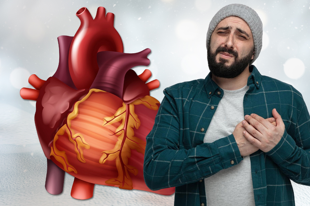 Is cold weather increasing your risk of a heart attack? Here's why it’s no laughing matter.